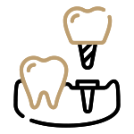 Implanty<br/> zębów