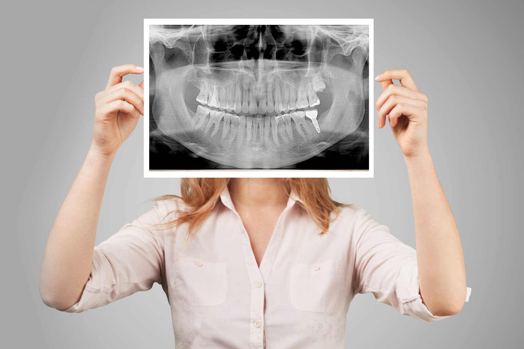 tomografia stożkowa zębów warszawa